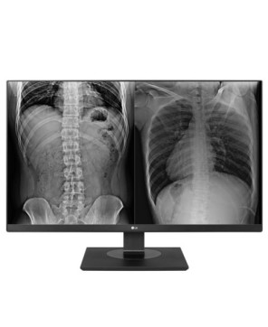 Buy LG 27HJ713C-B 27” 8MP IPS Clinical Review Monitor