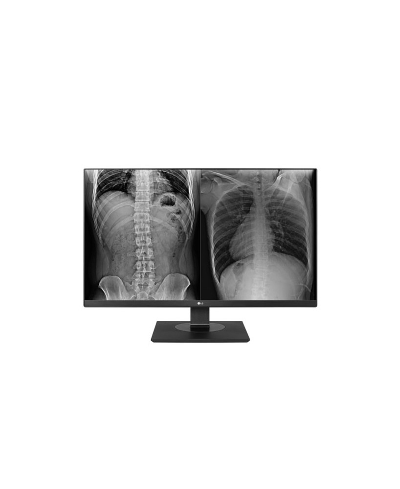 Buy LG 27HJ713C-B 27” 8MP IPS Clinical Review Monitor