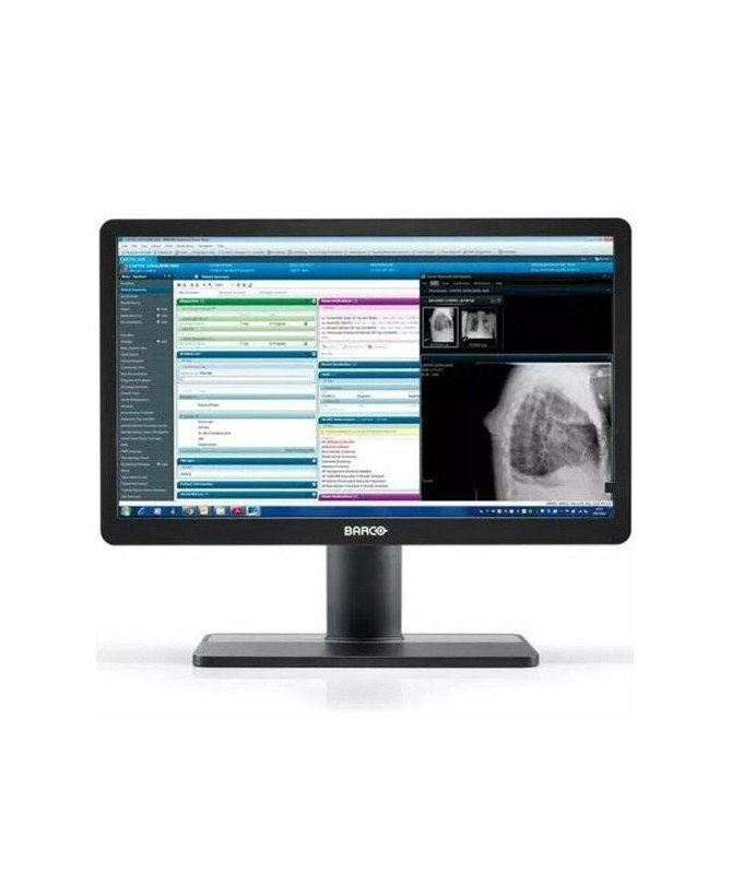 Barco MDRC-2222 BL 22" Clinical Display Monitor K9307944B